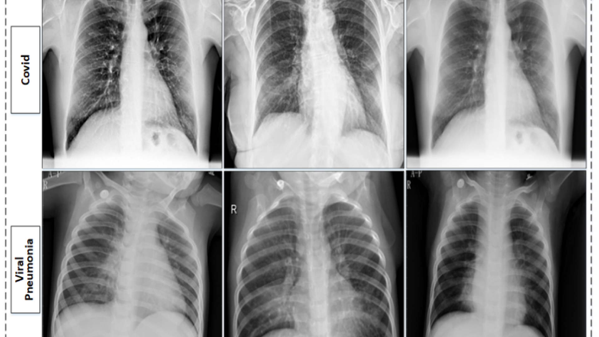 Master AI for Disease Detection from Symptoms or X-ray Inputs